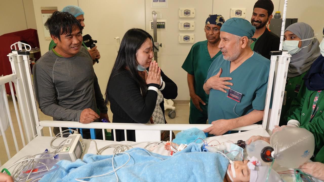Saudi Conjoined Twins Program Successfully Separates Filipino Twins in Riyadh
